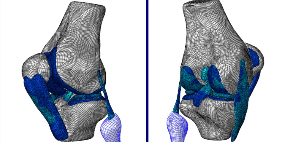 An image of a human bone being analyzed by the finite element method